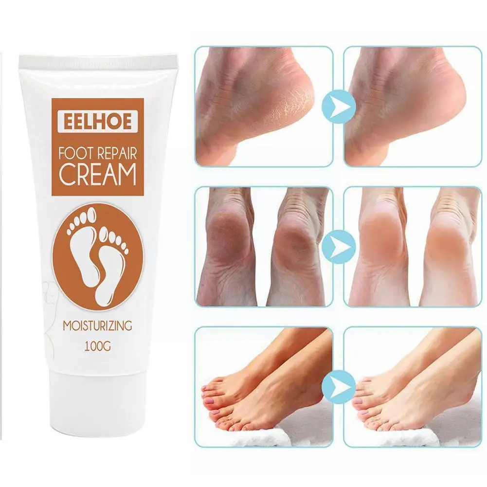 

Medical Plaster Foot Corn Removal Wart Thorn Cream Corns Corns Calluses Detoxification Sheet Medical Foot Cream R9N2