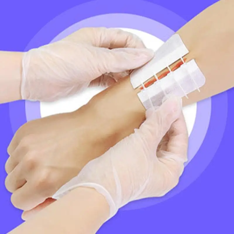 

2pc Zipper Band-aid Painless Wound Closure Device Without Needles Suture-free Wound Dressing Patch Zip Suture Reducer Band Aid