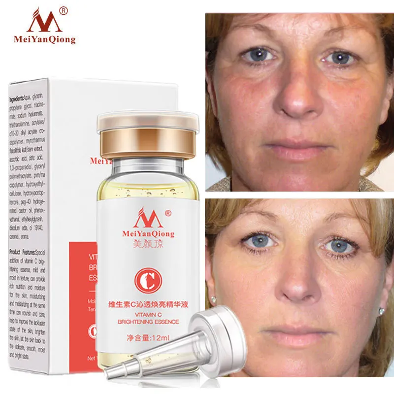 

Vitamin C Whitening Face Serum Remove Freckle Spots Fade Pigment Melanin Brightening Moisturizing Facial Skin Care MeiYanQiong