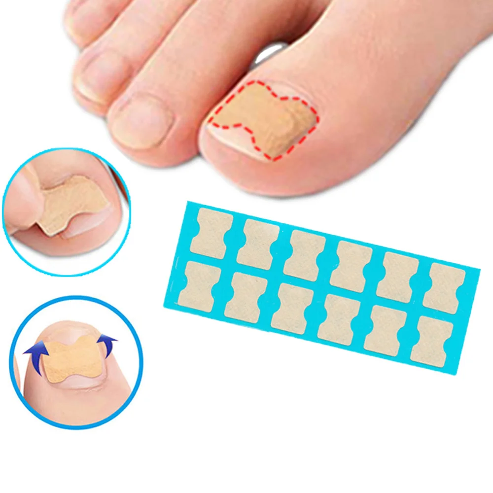 3 листа/всего 36 шт. коррекция вросшей лапки|Инструмент для ухода за ступнями| |