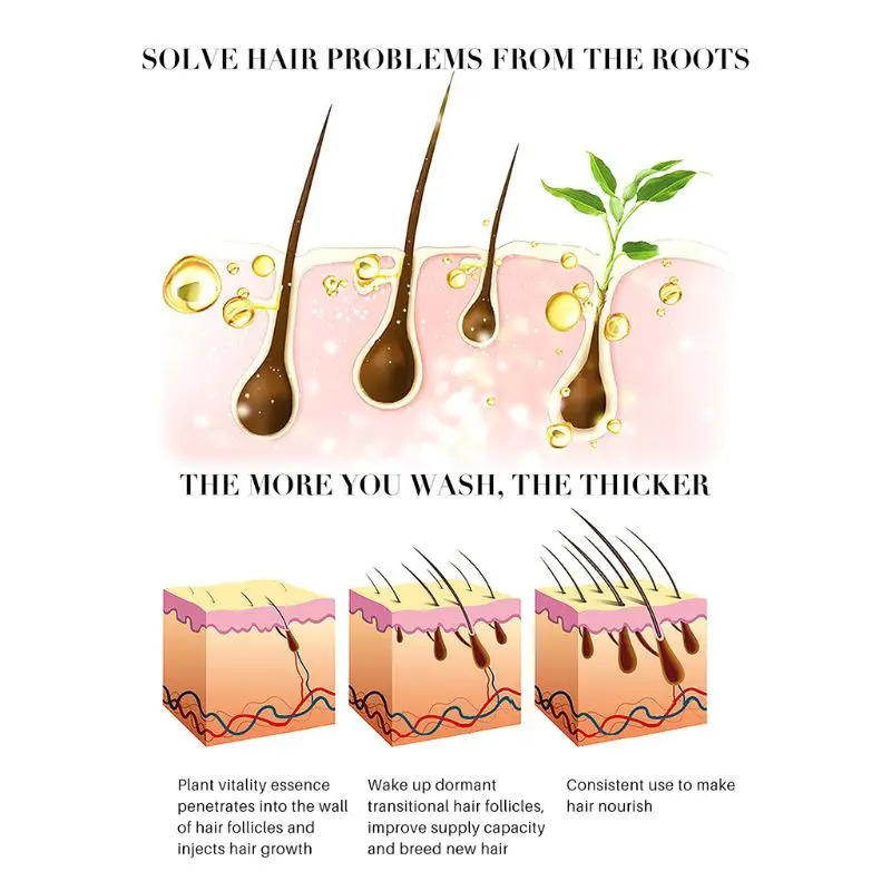 

Herbal Ginger Ginseng Extract Hair Shampoo Essence Regrowth Treatment