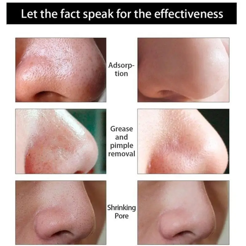 Hot Green Tea Ice Muscle Mud Mask Anti-Acne Face Cream Pores Removal Shrink Acne Care Scar Essence Skin Cream Blackheads N9A9