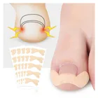 Корректор для вросших ног, наклейка для лечения паронихии, корректор бурсита, педикюр, инструмент для ухода за ногтями