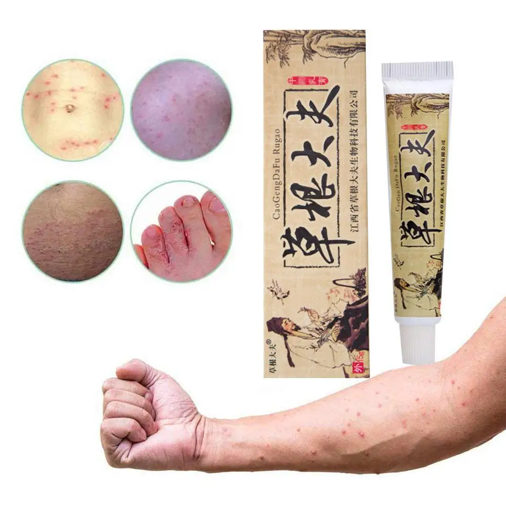 Китайский травяной крем от псориаза кожи зуд рельеф для тела Tinea versicolor Balanitis
