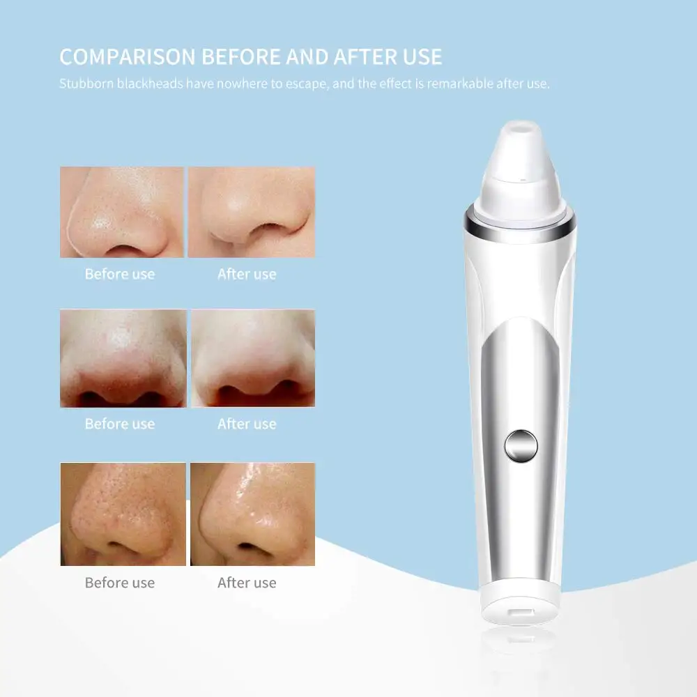 Перезаряжаемый инструмент для красоты средство удаления черных точек очистки