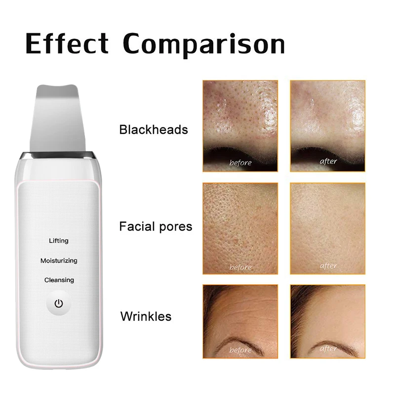 

Ultrasonic Skin Scrubber Vibrate Deep Face Cleaning Machine Peeling Shovel Cleaner Blackhead Acne Remover Face Lifting Tool