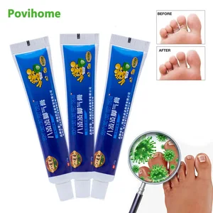 Крем берибери, 13 шт., противогрибковые инфекции, мазь для ухода за ногами, эрозионный пилинг, пластырь