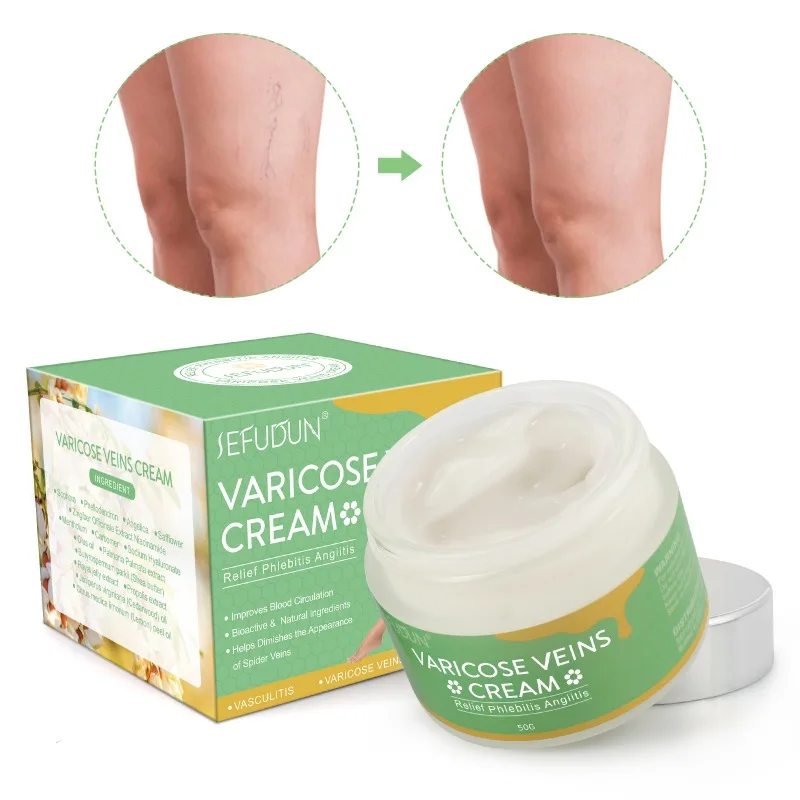 

Vein Cream Varicose Repair Leg Cream Repair Pain Relief Winter Body Care 50g I