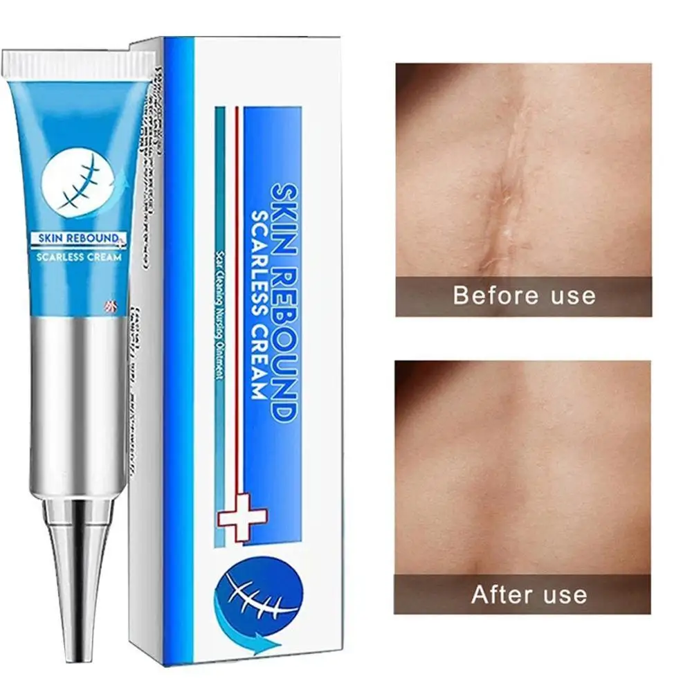 Scar Repair Cream Acne Treatment Face Blackhead Repair Moisturizer Whitening Skin Pores Care Oil Control Gel Shrink Scar M0Z1