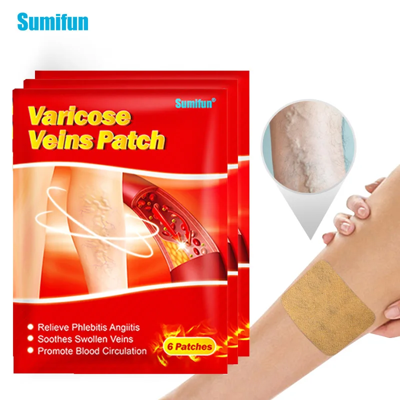 

6/18/24/30 шт варикозное расширение вен патчи для ног васкулит флебит паук анти-отек ангиит удаление китайские медицинские штукатурки