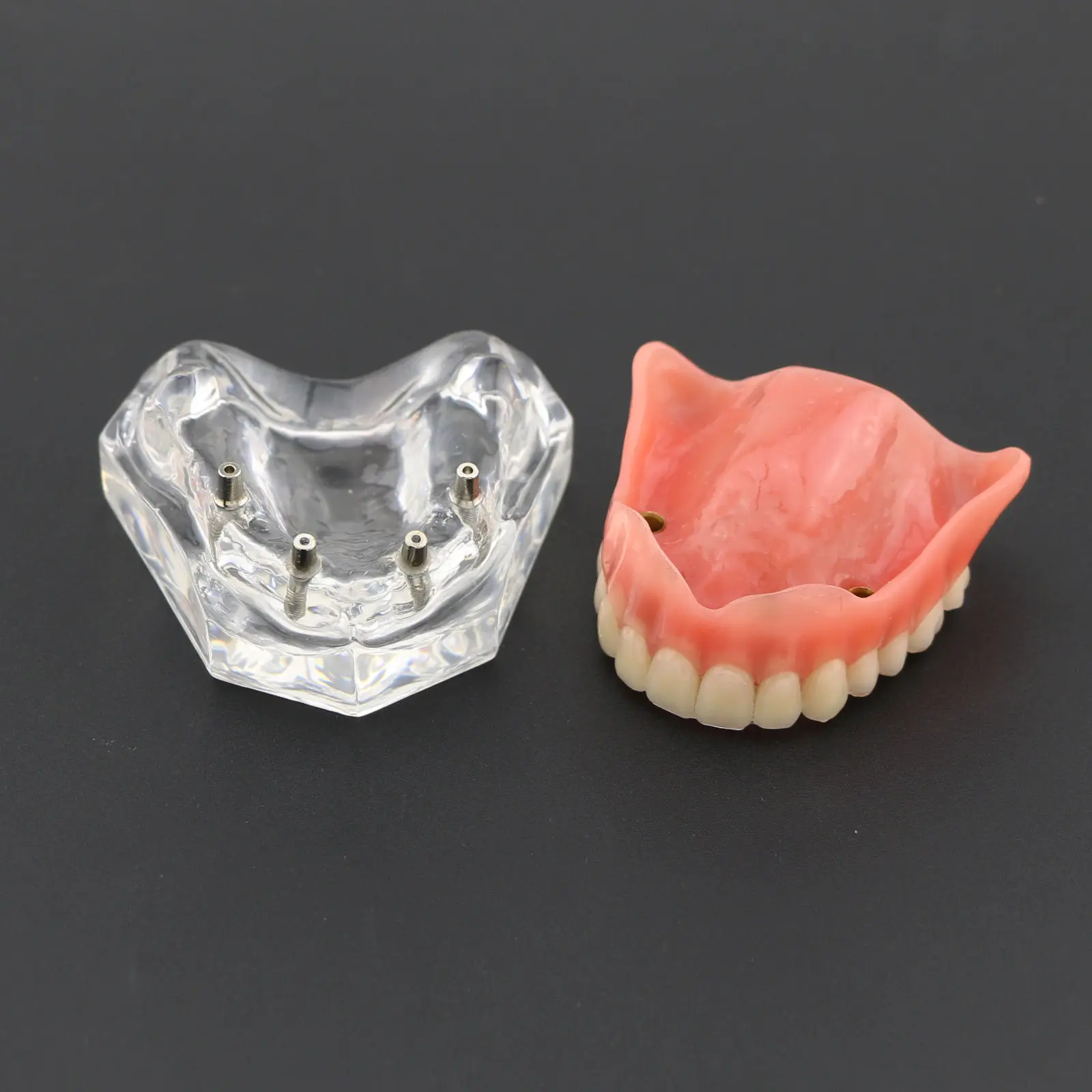 1 шт./упак. Dental Upper Overdenture Superior 4 имплантаты демо модель 6001 02