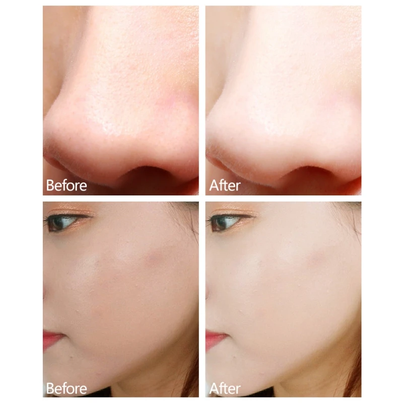 Крем для детоксикации кожи увлажняющий крем лица |