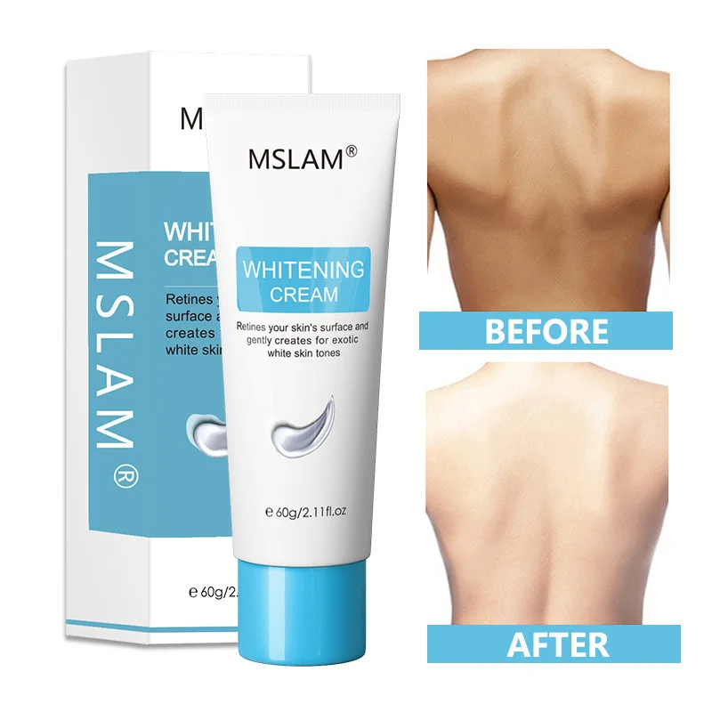 

Mslam clareamento creme hidratante nutrir reпарация melhorar brстали axilas tornozelos cotoвелосипед joelho корпус с подсветкой