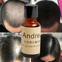 hot new 20ml essential oils herbal keratin fast hair growth essence loss liquid ginger dense fast grow restoration