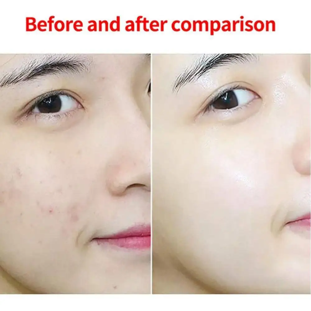 Sea Salt Soap Removal Pimple Pores Acne Treatment Cleaner Base Moisturizing Goat Soap Wash Skin Care Milk Face H6Y3