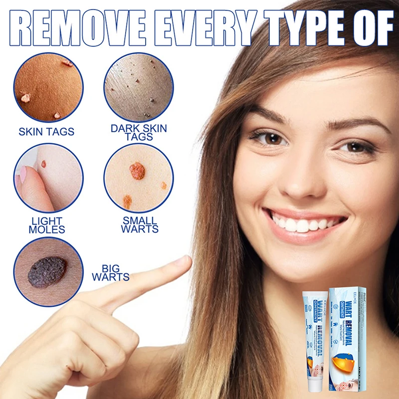 2Pcs Warts Remover Ointment Wart Treatment Cream Skin Tag Herbal | Красота и здоровье