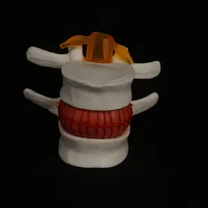 Бактериальная модель анатомического диска, грыжа, медицинское обучение, инструм