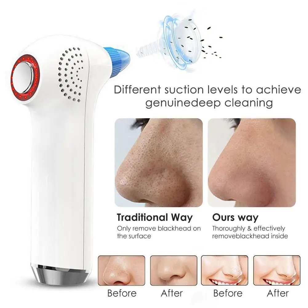 

USB Recharge Electric Blackhead Remover Safe Blackhead Pore Cleaner Device Hot And Cold Compress Facial Cleansing Skin Care Tool