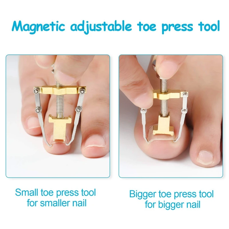 

2 Pcs Ingrown Toenail Lifter Ingrown Toenail Tool Toe Clamp for Paronychia