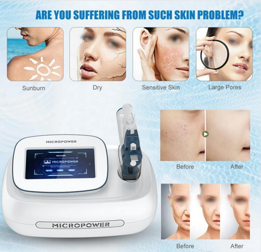 CE Approved RF Needle Free Meso Gun 3 Needle Tip For Eye Face And Body Skin Moisture Anti Wrinkle