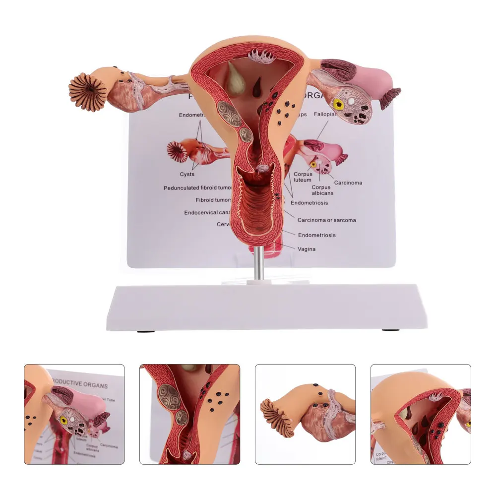 

1Pc Practical Uterus Model Female Reproductive System Model for Training