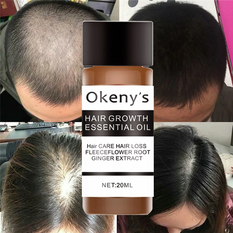 Okeny's быстрые мощные средства с эссенцией для рост волос Эфирное Масло жидкое