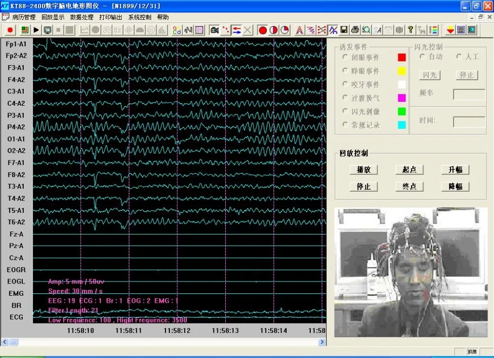 KT88-2400 Digital 24 Channel EEG Machine Brain Electric Activity Mapping SystemsEMG EOG ECG Breath+PC software+2 bracket | Красота и