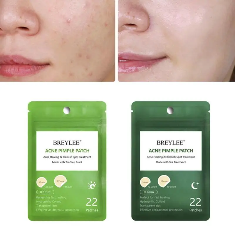 

Acne Pimple Patch Invisible Acne Stickers Effectively Tool Mask Remove Care Treatment Blemish Skin Pimples Removers Acne C7Q6