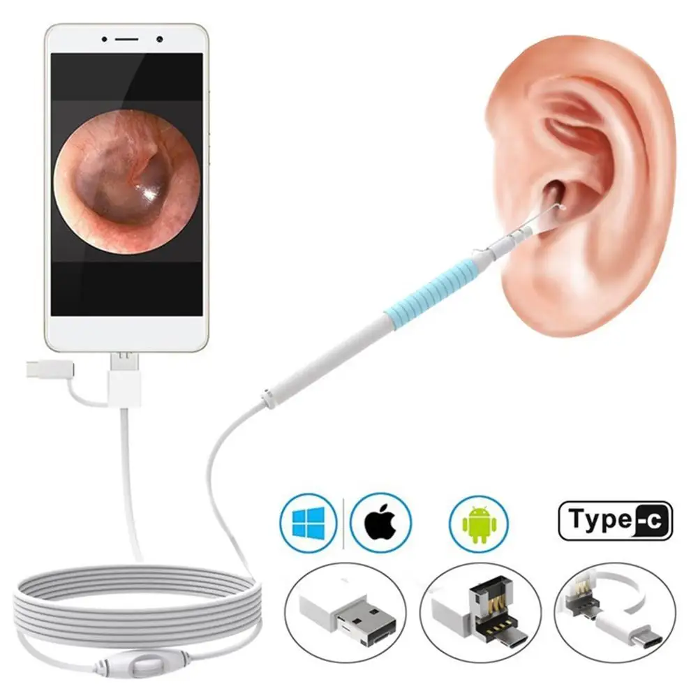

Ушной эндоскоп 3 в 1, инструмент для чистки ушей, HD визуальная ложка, многофункциональный ушной пинцет, отоскоп для ушей с мини-камерой