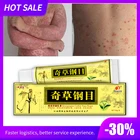 Крем QICAOGANGMU Focallure для кожи, мазь для лечения псориаза, чешуи, зубного налета, экземы