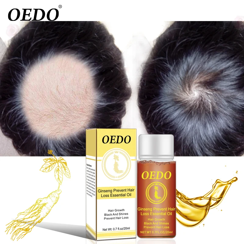 

OEDO Ginseng Hair Growth Essence Oil Anti-Hair Loss Fast Powerful Hair Products Dense Fast Restorating Scal Treatment 20ml