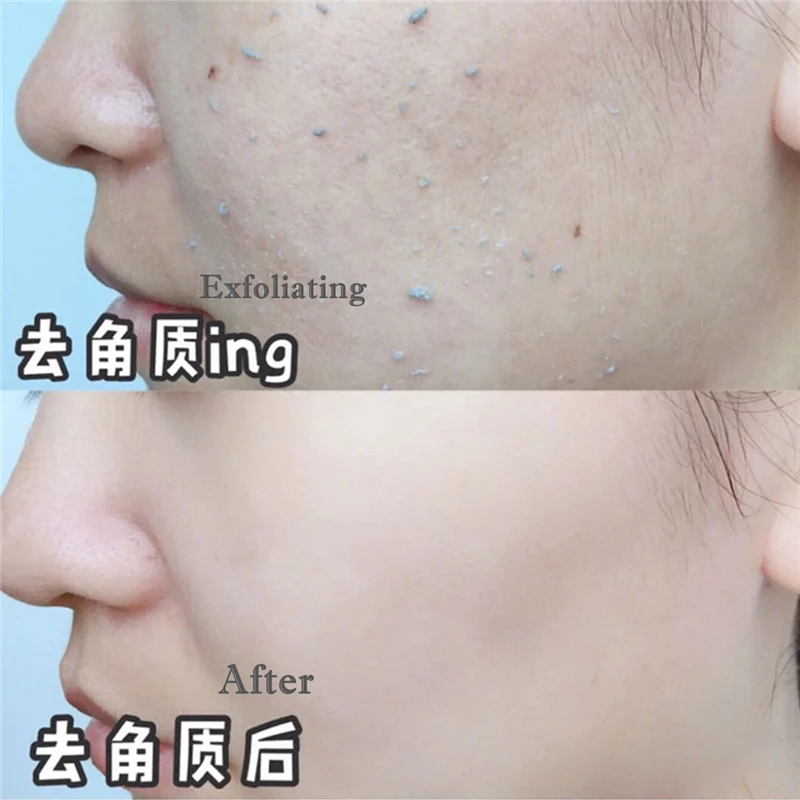 Niacinamide Отшелушивающий Пенящийся мусс пилинг гель глубокое очищение увлажняющее