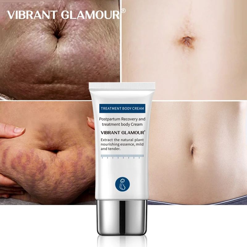 Crocodile Stretch Marks Remover Cream Anti Aging Winkles Firming Body Care Pregnancy Scars Ance Maternity Repair Dropshipping |