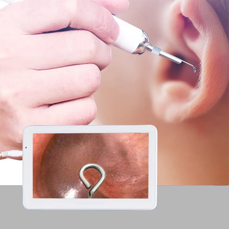 7-дюймовый дисплей 3,9 мм Встроенная отоскоп визуальный Ларингоскоп otolaryngoscope вагинальный эндоскопа Визуальный ухо совок