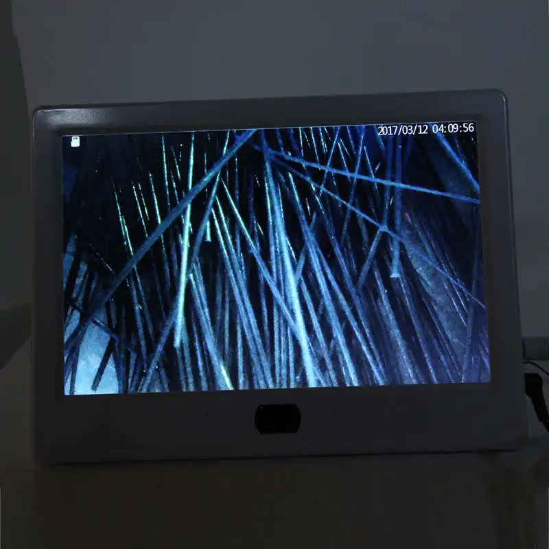 

13inch Skin Scalp Detector MultiFunctional Hair Follicle Skin Analyser Machine