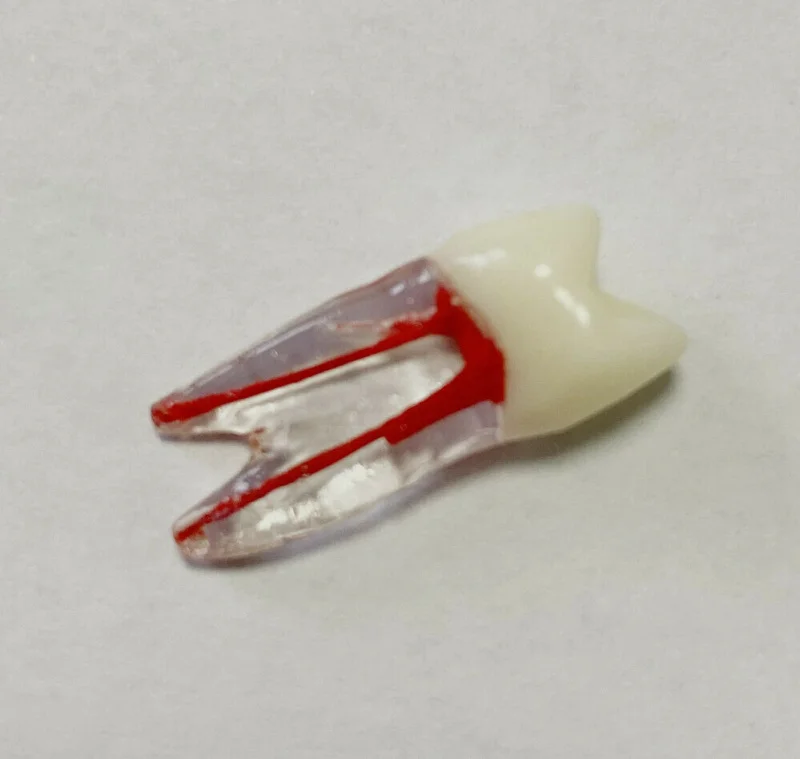 

1~100pcs Dental Blocks Files Practice Red Pulp Root RCT Stimulation Bicuspid 14#