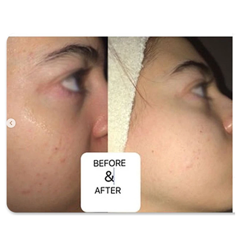 Увлажняющая сыворотка для лица с растительным производителем сквалана 100% |