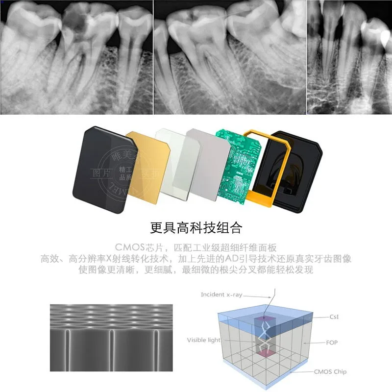 Стоматологический рентгеновский аппарат высокочастотный цифровой портативный