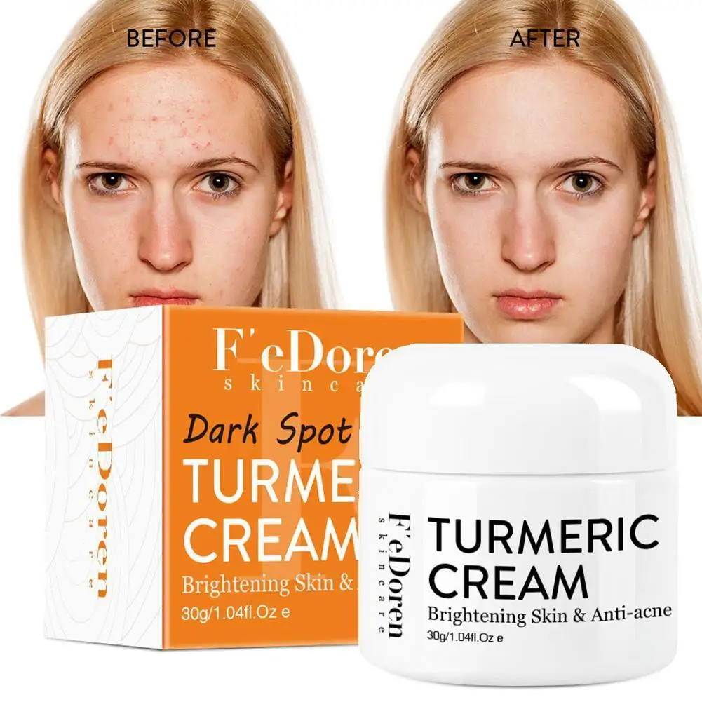 

Herb Turmeric Face Cream Repair Acnes Scar Dark Spot Treatment Moisturizer Whitening Lightening Against Acne Skin Care 30Ml