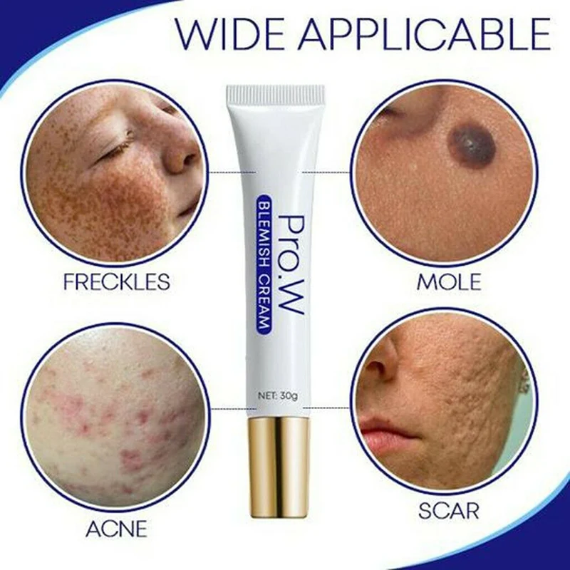

Pro.W Blemish Cream Freckles Acne Pimple Scar Dark Spots Removal Skin Whitening Brightening ALS88