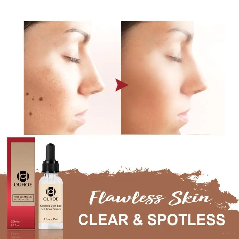 

1 Pcs Organic Skin Tag Remover Spot Purifying Essence Repair Skin Moles And Tag Face Serum Skin Care TSLM1