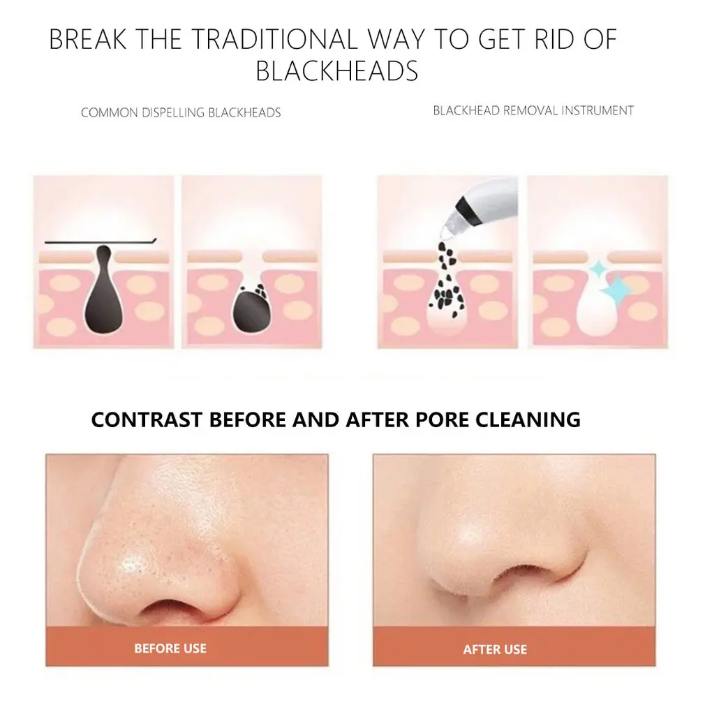 Портативный USB Перезаряжаемый вакуумный Электрический Очиститель пор для лица