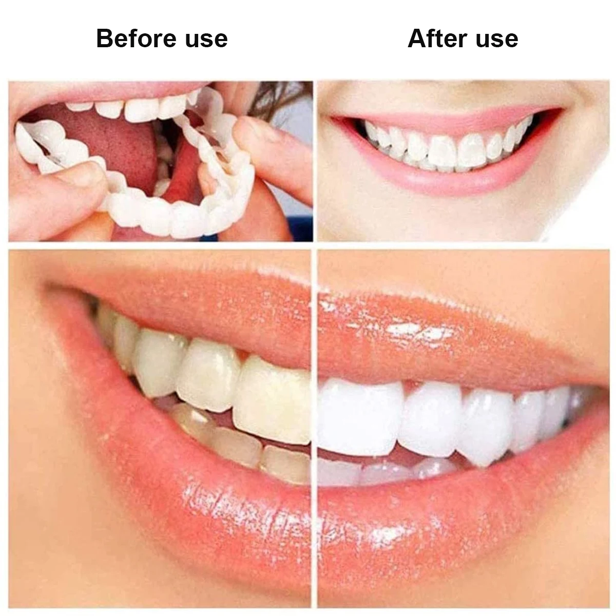 

5pcs Cosmetic Temporary Denture Teeth Whitening Denture Upper/Lower Fake Tooth Cover Perfect Smile Veneers Teeth Oral Care