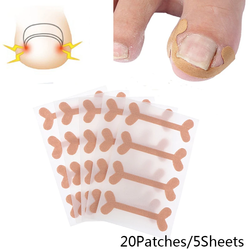20Patches Ingrown Toenail Band Aid Relief Pain Paronychia Correction Pedicure Elastic Force Sticker Repair Bandage Toe Nail Care