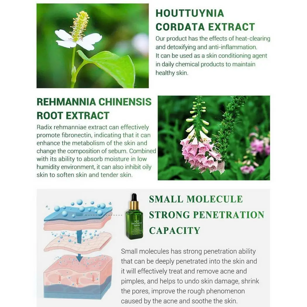 Угревая угревая головка усадка поры ремонт Сделано Китай маска для носа против