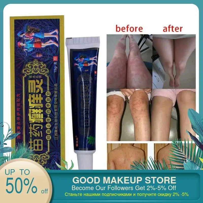 1 шт. мазь от бактериостаза для противовоспалительного псориаз дерматит экземы