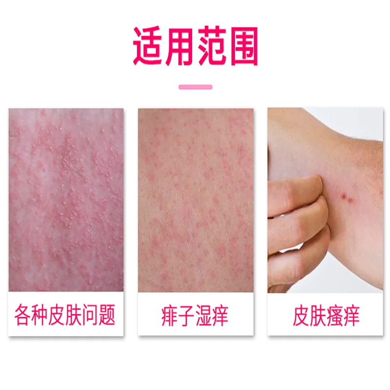 

Gaitianling skin cleansing skin itching sterilization calamine antibacterial lotion 100ml