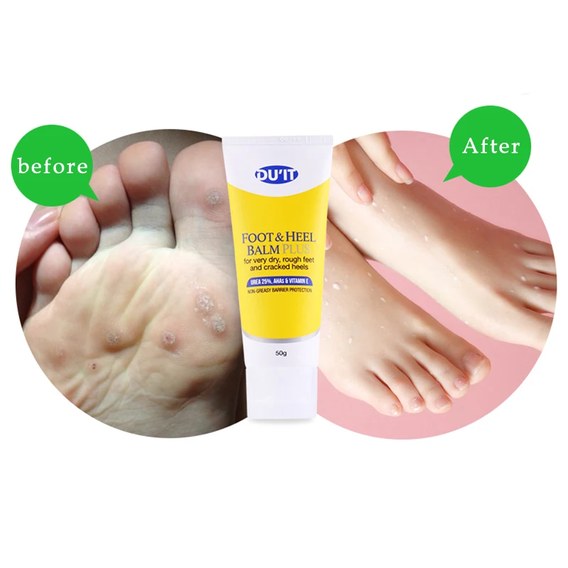 DU'IT Foot & Heel Balm Plus Ремонт очень сухих грубых трещин на стопах и пятках Нежирный