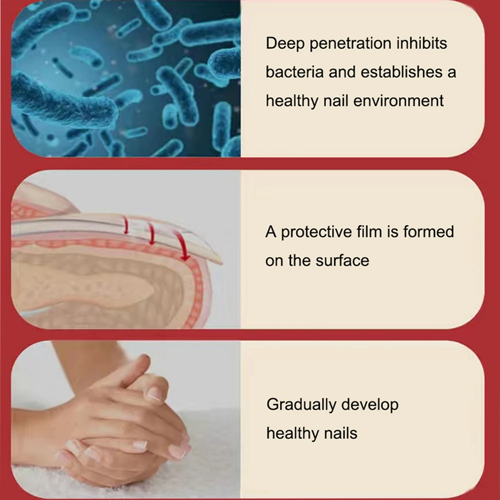 Противогрибковая Сыворотка для ногтей уход восстановление эссенция паронихия