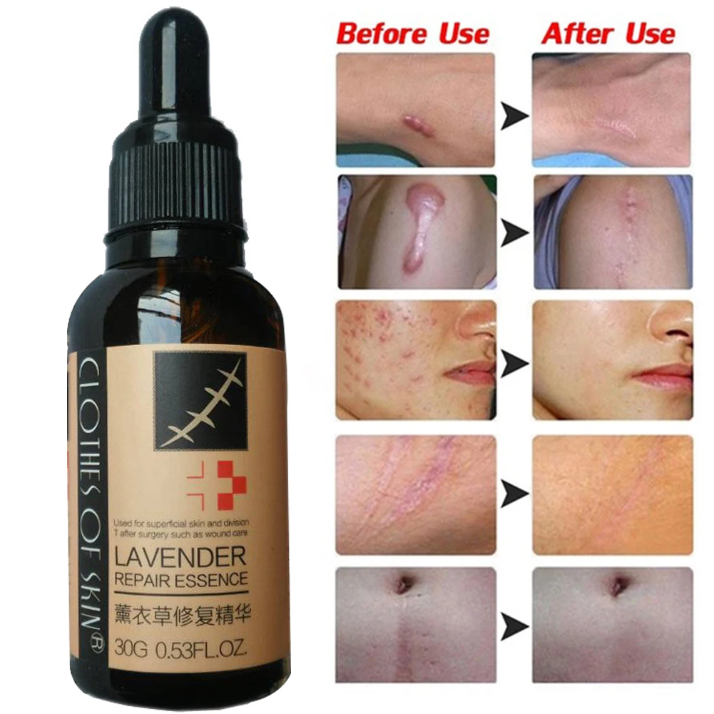 Лечение гладкой кожи восстановление эссенция для ухода за кожей лаванда дезальт